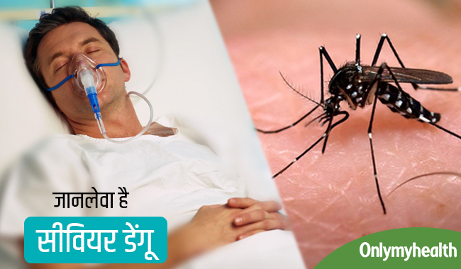 जानिए डेंगू का बुखार कब हो जाता है खतरनाक और क्या हैं सीवियर डेंगू के लक्षण?